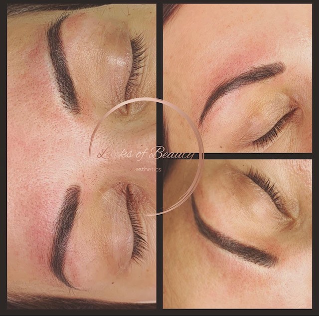 Brow treatment close-up photographs