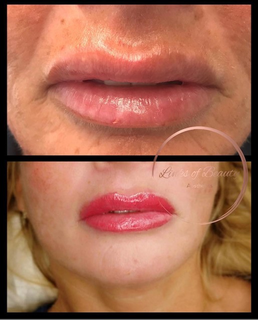 Full lip colour, before and after