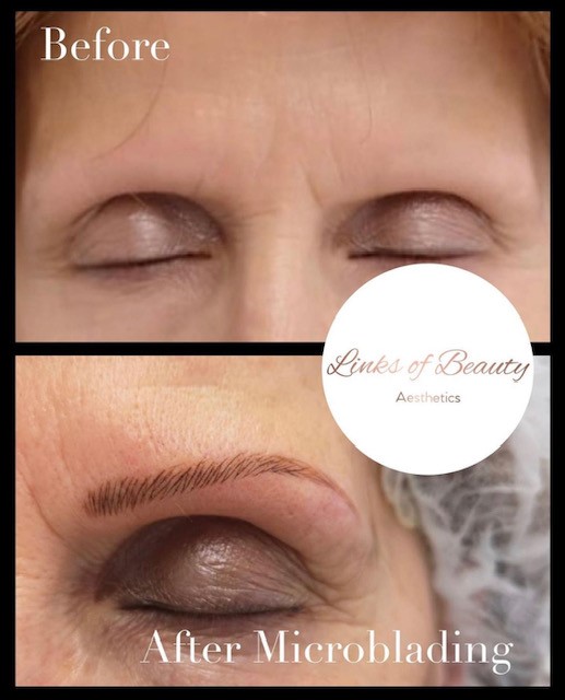 Microblading before and after comparison