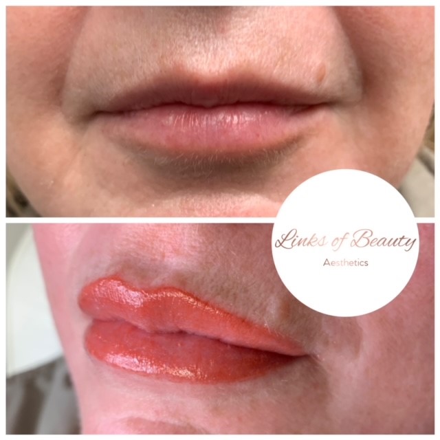 Lip liner and lip blush, before and after
