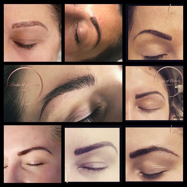 A collage of healed brow results