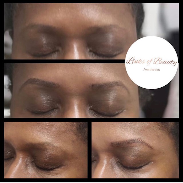 Brow treatment before and after comparison
